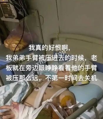 住院裁员