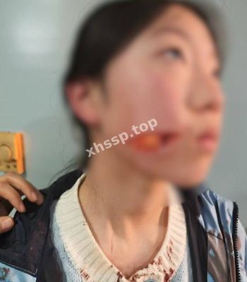 社会热议