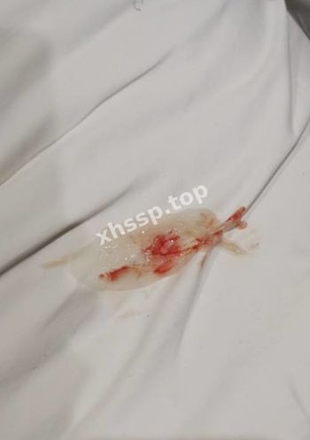 分手曝光
