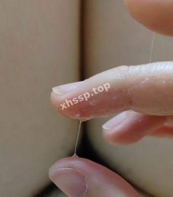 李琴